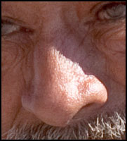 reference photo of nose